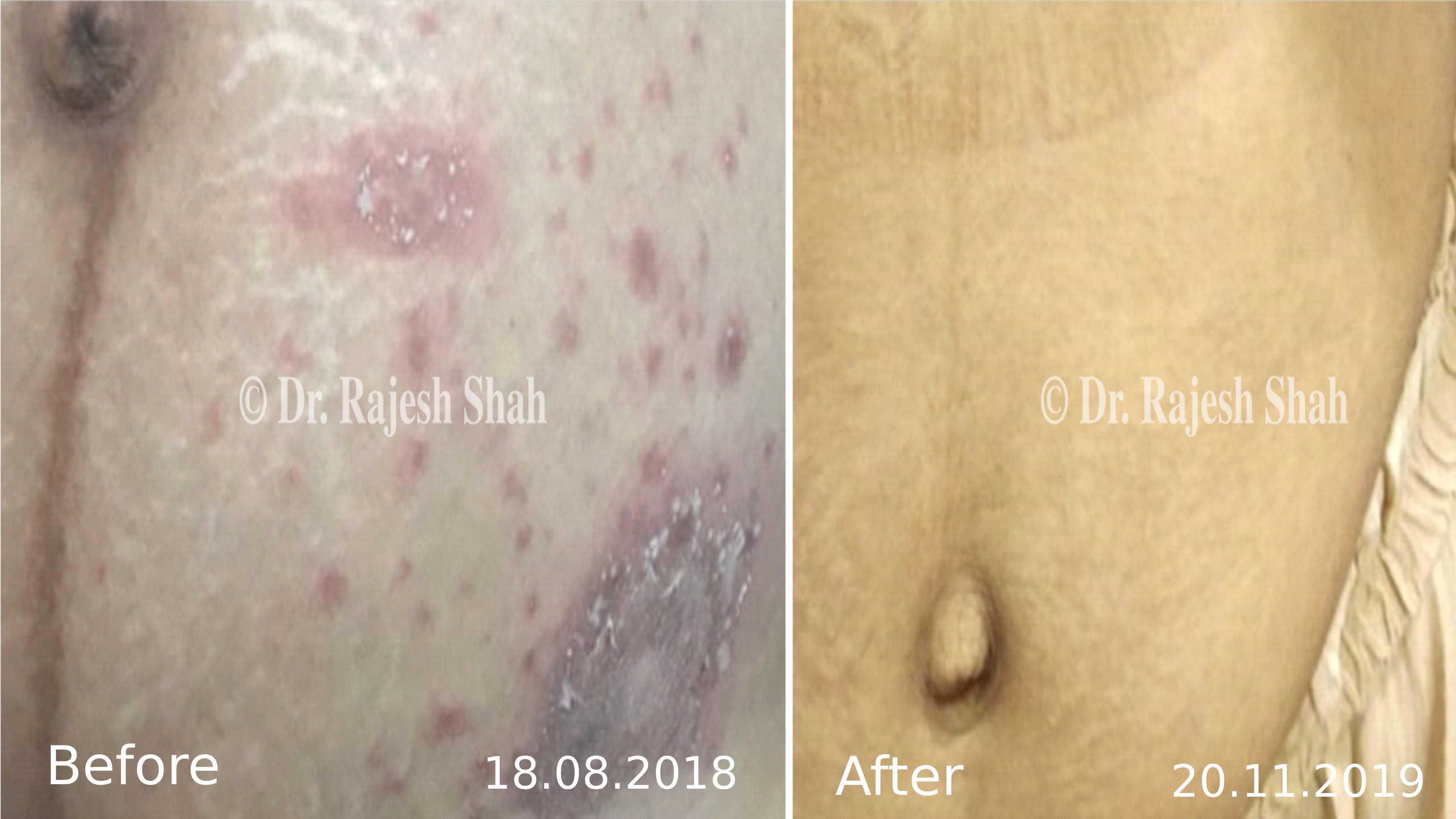 lifeforce homeopathy case-photos